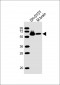 DPYSL5 Antibody